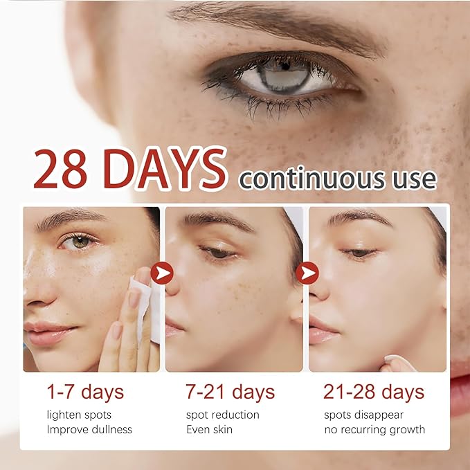 Gleamify™-EELHOE Pigment Correcting Cream-Dark Spot Remover & Skin Brightening Moisturizer (30g) - Coolmania