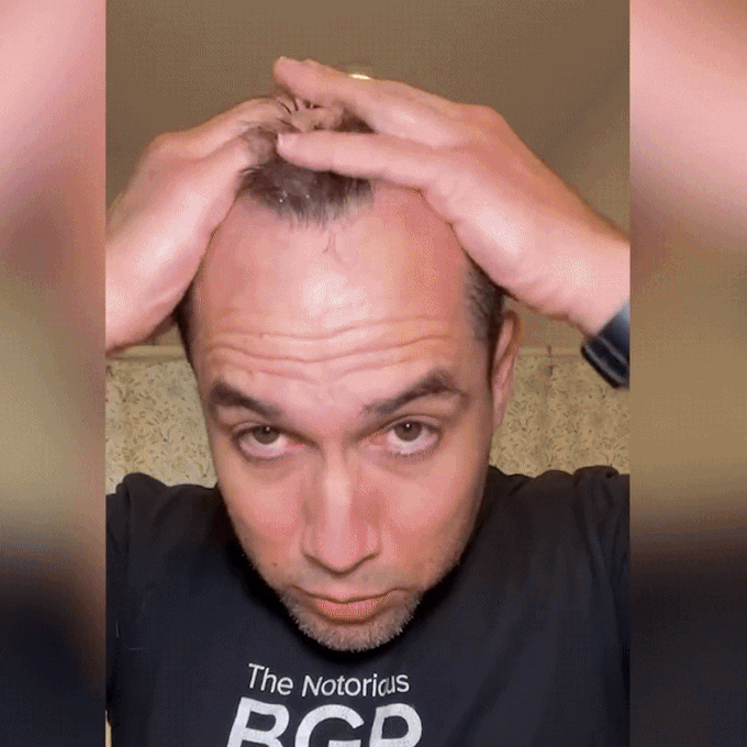 Gleamify™-FEG Hair Growth Spray-Natural Hair Regrowth & Strengthening Solution - Coolmania